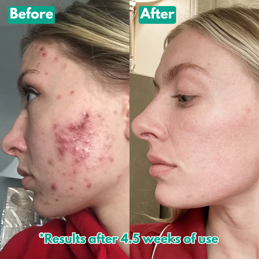 Arekya™ Microcrystal Serum PM Duo