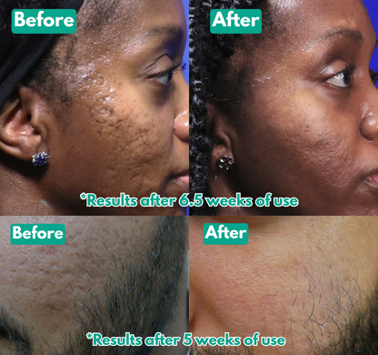 Arekya™ Microcrystal Serum PM Duo