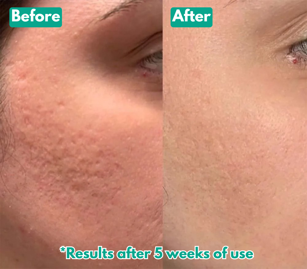 Arekya™ Microcrystal Serum PM Duo