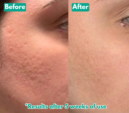 Arekya™ Microcrystal Serum PM Duo